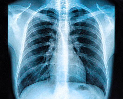 image of an x-ray