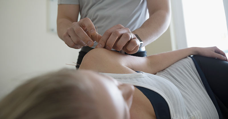 woman receiving acupuncture treatment to her arm